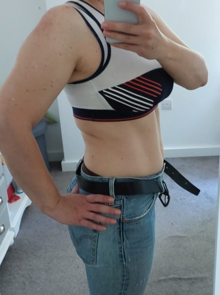 Waistline after five B-Flexy sessions